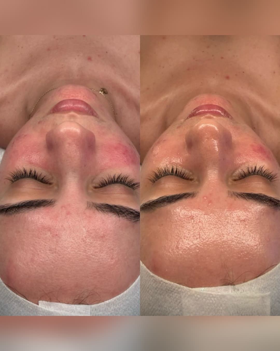 Facial Unstress
